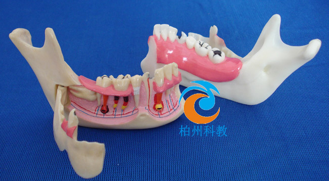 右侧下颌骨组织模型
